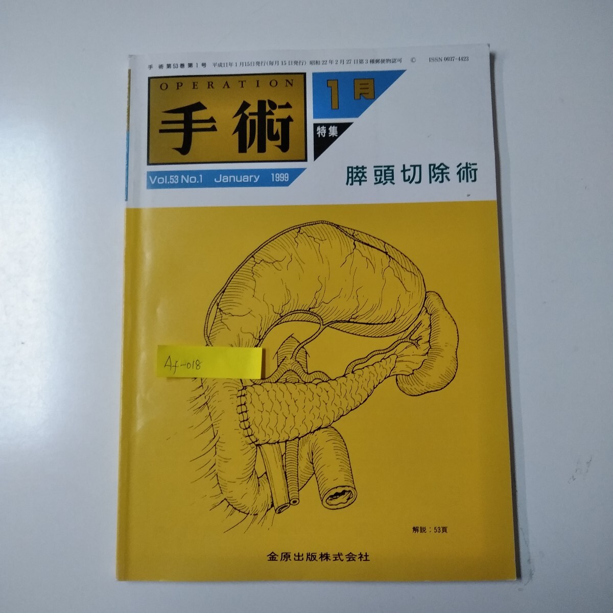 Af-018/手術第53巻第1号1月1999年1月膵頭切除術解読:53ページ金原出版株式会社/L3/70212拍卖