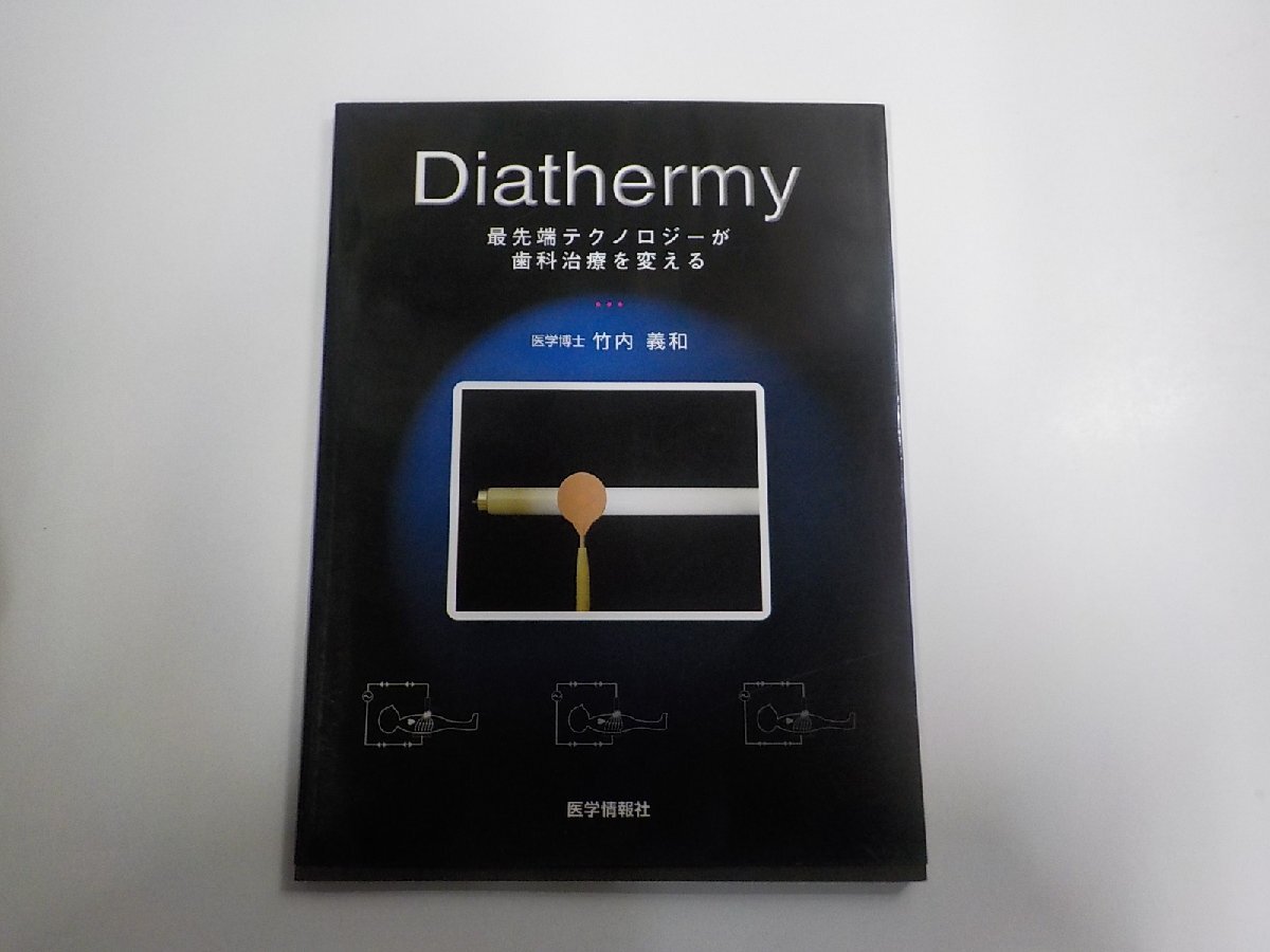 6P0371◆DIATHERMY 最先端テクノロジーが歯科治療を変える 竹内義和 医学情報社 シミ・汚れ有(ク)拍卖