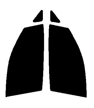 グロウゴースト91 AR91 運転席、助手席 エルグランド E52 カット済み フィルム拍卖