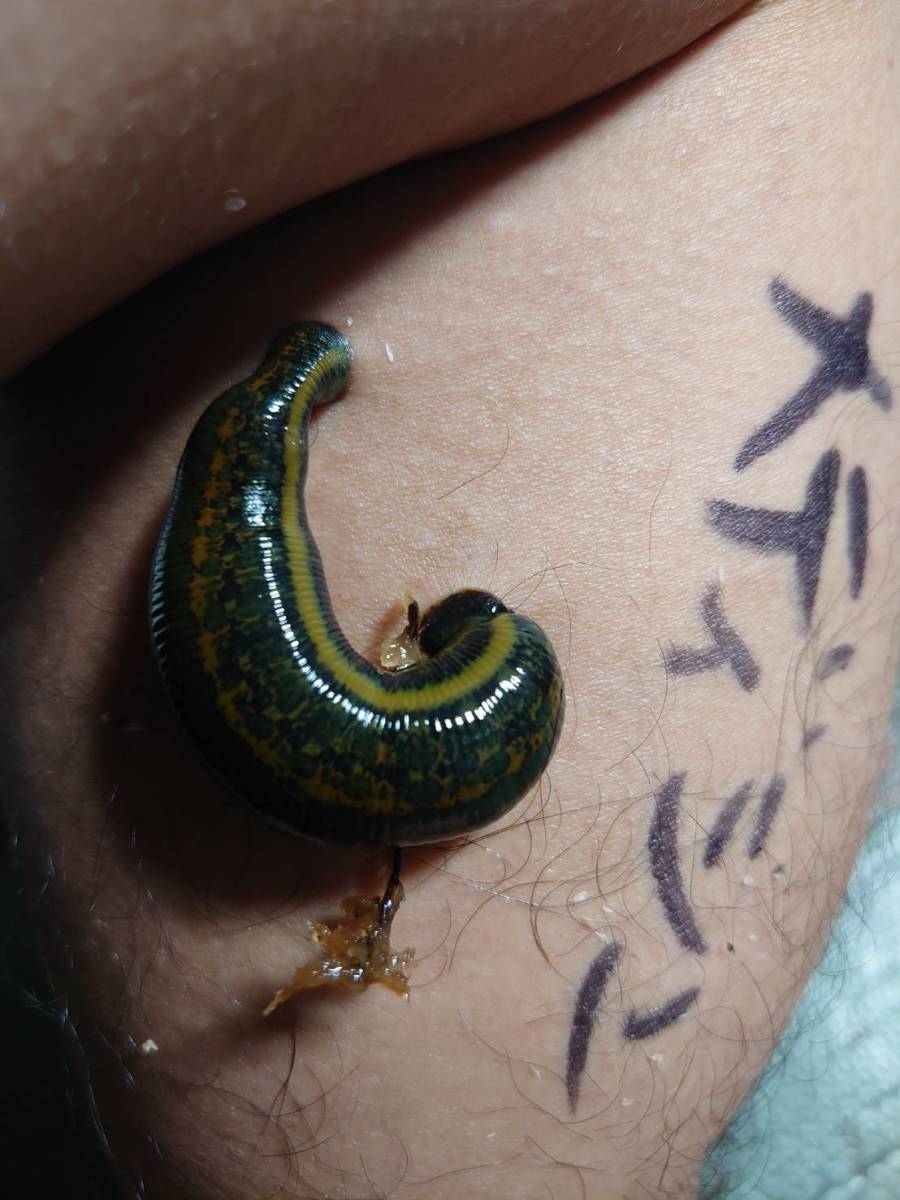 人血未吸血の清潔安心の医療用 ヨーロッパチスイビル Hirudo medicinalis ヒル拍卖