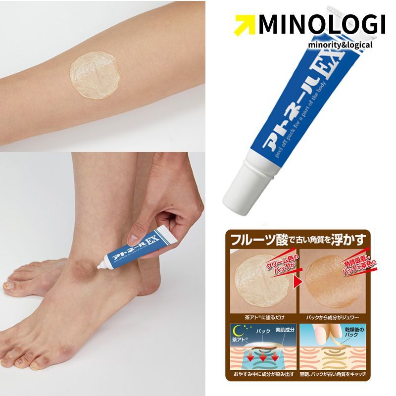 マイノロジ アトネール EX 15g かかと パック くるぶし 黒ずみ 角質 硬化 除去 対策 かかと クリーム 角質ケア拍卖