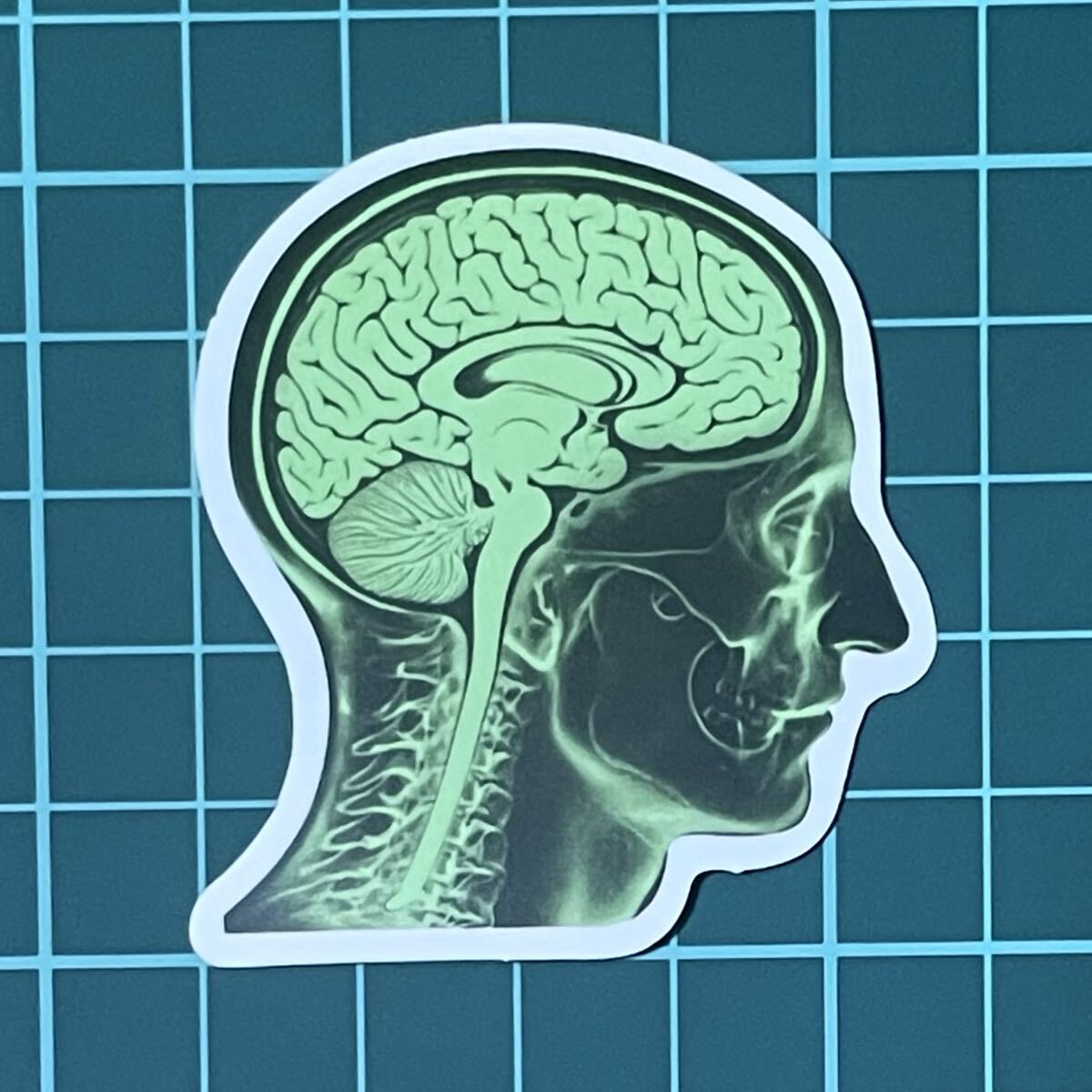 ST703 ステッカー シール 頭蓋骨 スカル 骸骨 レントゲン 病院 医療拍卖