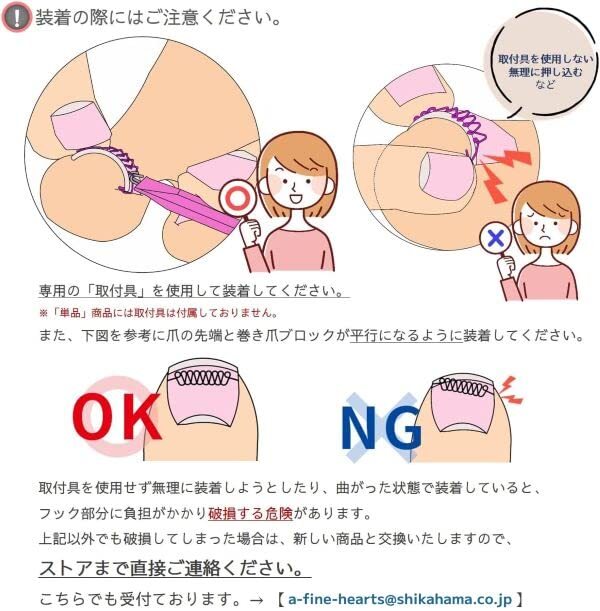 巻き爪ブロック 取付具セット拍卖