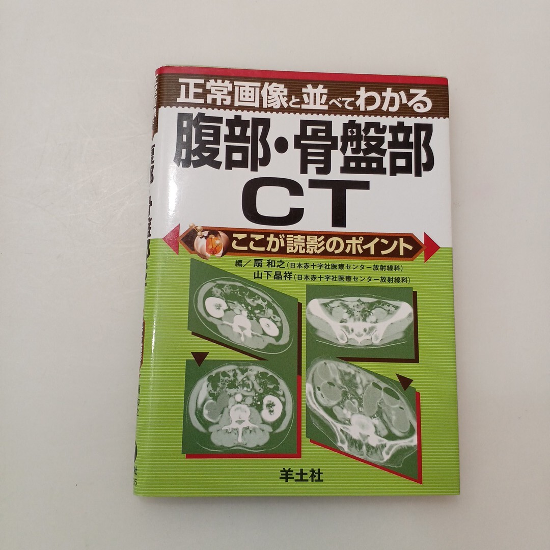 zaa-663♪正常画像と並べてわかる腹部・骨盤部CT - ここが読影のポイント 扇和之/山下晶祥 羊土社(2005/04発売)拍卖