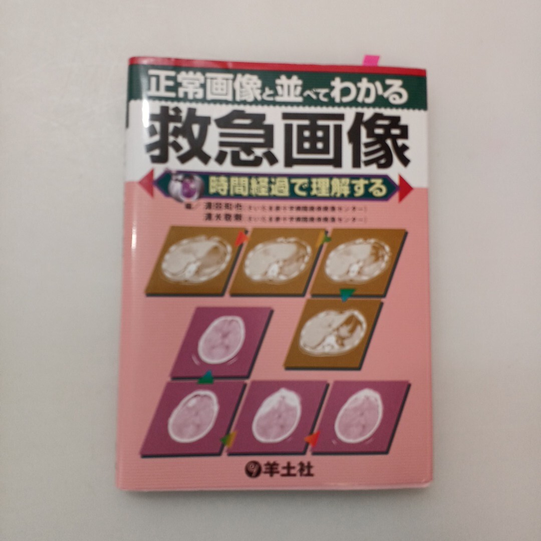 zaa-663♪正常画像と並べてわかる 救急画像 改訂版 〜時間経過で理解する 単行本 清田和也 (編集), 清水敬樹 (編集)羊土社 (2012/4/9)拍卖