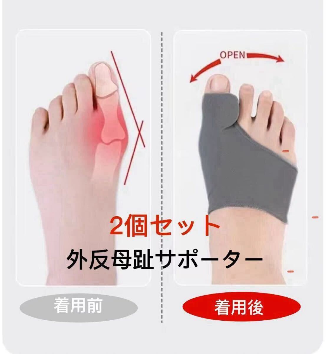 外反母趾サポーター 外反母趾グッズ フリーサイズ 男女兼用 左右兼用/2点セット拍卖