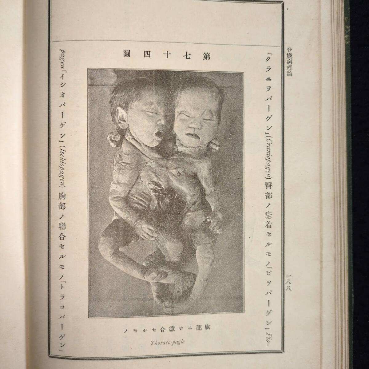 Y659 医学 絵入◆産科学講義◆婦人科 出産 奇形 先天性 病理 医書 中島襄吉 明治時代物 浮世絵UKIYOE 骨董 古美術 古典籍 古文書 和本 古書拍卖