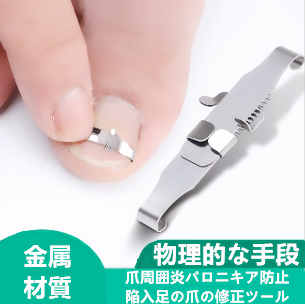 爪周囲炎防止 陥入爪・巻き爪 矯正 セルフケアキット 足 フット拍卖