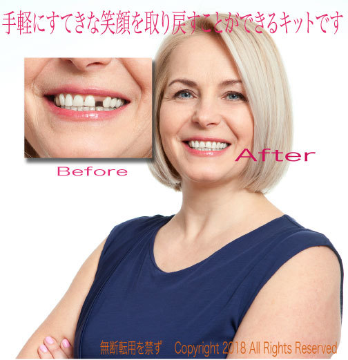 本物です/ ヤフオクの偽物出品者に注意!!!インスタントスマイル テンポラリートゥースキット・マルチシェイド <ナチュラル>拍卖