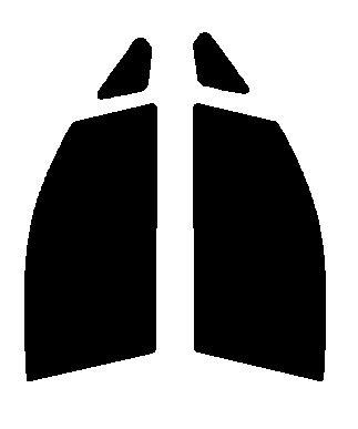 スパッタゴールド80 運転席・助手席 ムーヴ ムーブ LA100S・LA110S カット済みカーフィルム拍卖