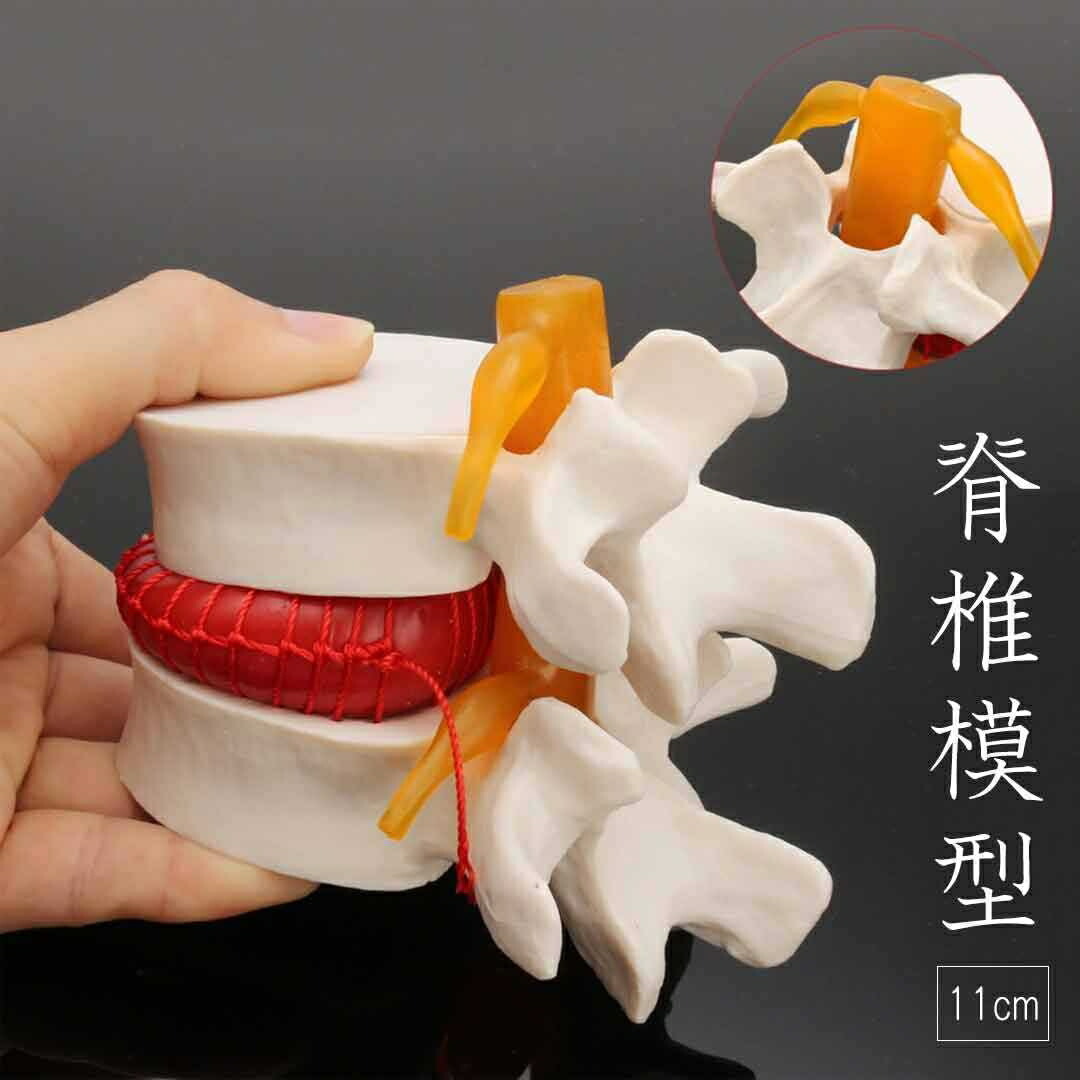人体模型 脊椎 骨 腰椎 脊髄 実物大模型 実物大男性骨盤 脊柱可動 ヘルニア病部 脊髄神経根 椎骨動脈 椎間板 背骨 教材 実験 外科 拍卖