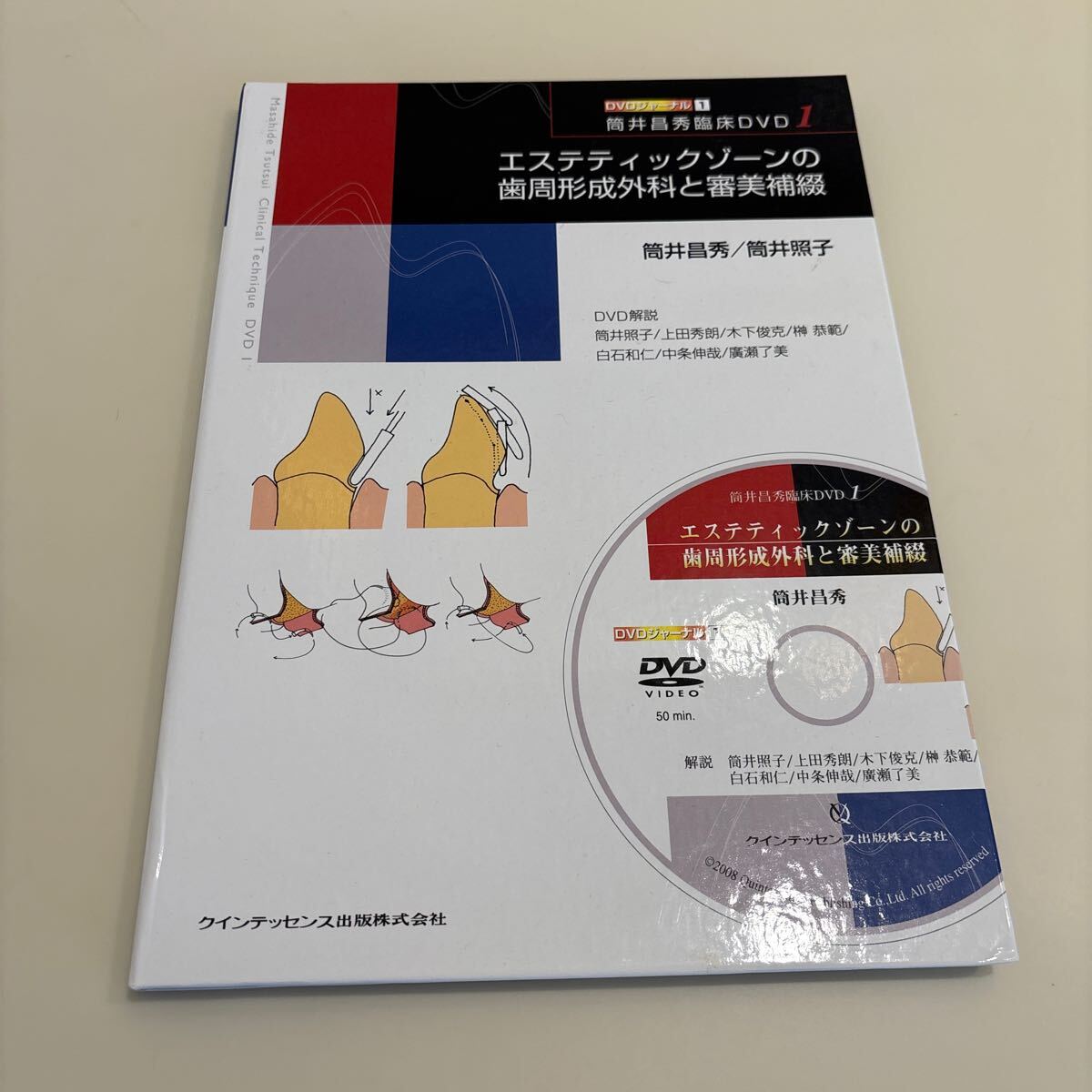 歯科本 エステティックゾーンの歯周形成外科と審美 (DVDジャーナル1) 筒井 昌秀著 筒井 照子 著 定価13,000円拍卖