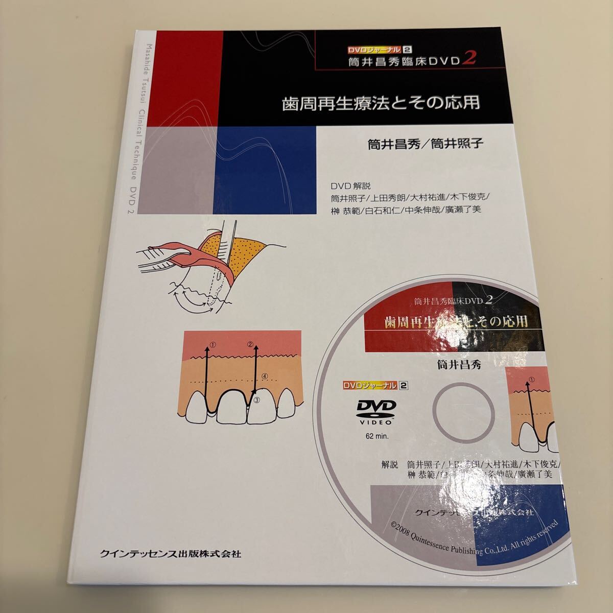 歯科本 歯周再生療法とその応用 筒井昌秀臨床2 (DVDジャーナル2) 筒井 昌秀著 筒井 照子著 定価13,000円 絶版書拍卖