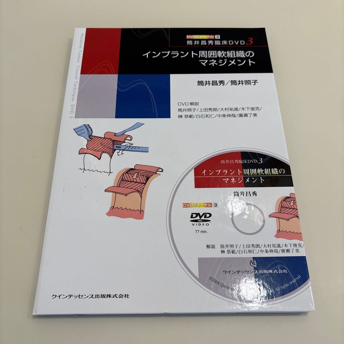歯科本 インプラント周囲軟組織のマネジメント 筒井昌秀臨床DVD付き3 DVDジャーナル3/筒井昌秀 (著者) 筒井照子 (著者)定価15,000円拍卖