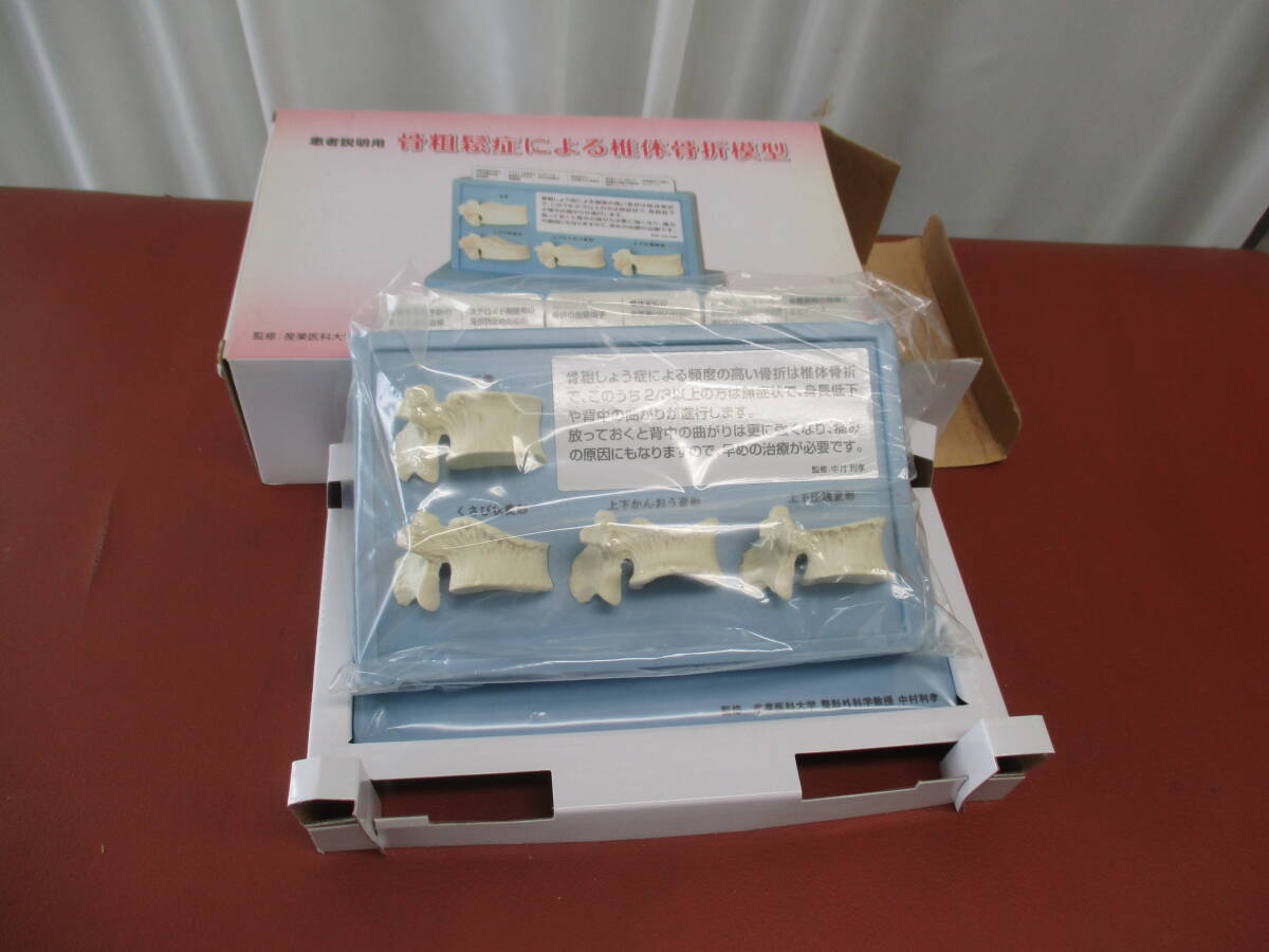 患者説明用 骨粗鬆症による椎体骨折模型