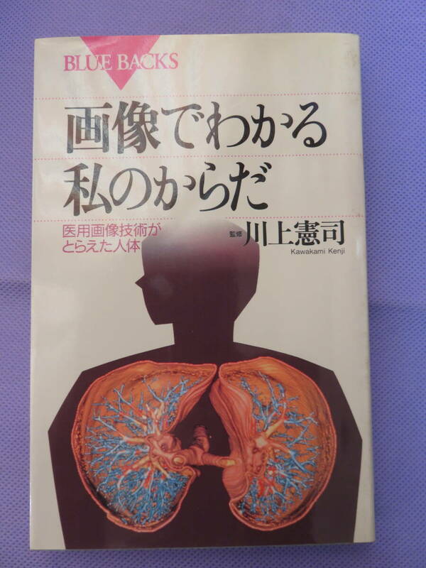 画像でわかる私のからだ　医用画像技術がとらえた人体　　監修：川上憲司　講談社　1996年