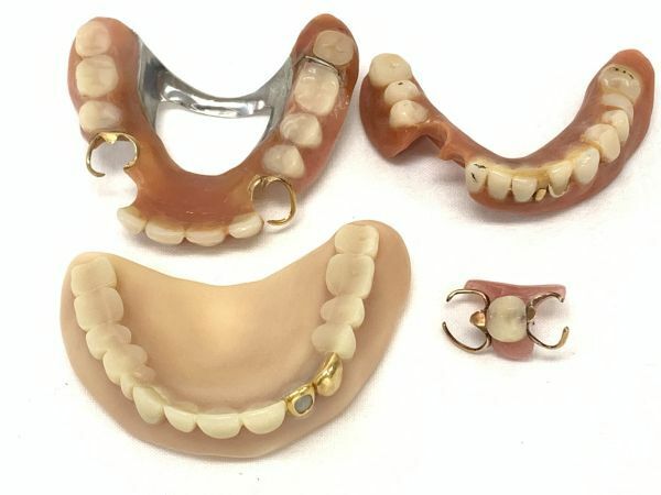 現状品 古い金歯 入れ歯 総重量約41.64g まとめてセット 義歯 被せ物 歯科技工 歯科材料 デンタル 詳細不明