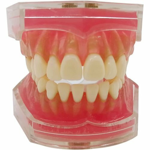 歯列模型 取り外し可能 研究治療説明用 上下顎模型 歯科模型 歯科インプラント 歯が抜く説明モデル 79